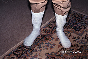 White socks can help reveal if adult fleas are present in an area. 