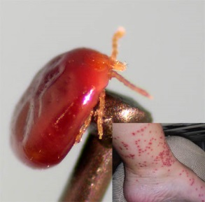 Six-Legged Tick Larva, Partially Engorged