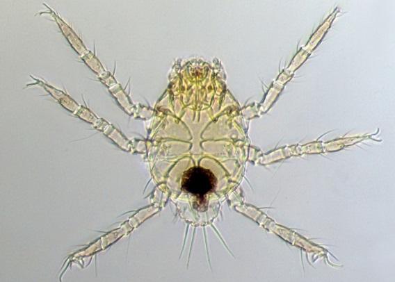 As immature mites, chiggers only have six legs. They are almost invisible to the naked eye