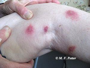 Chigger bites produce hardened welts that itch intensely. Chigger bites produce hardened welts that itch intensely.